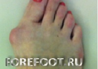 Клинический результат до операции