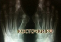 Клинический результат до операции