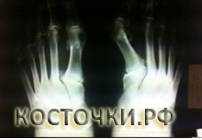Клинический результат до операции